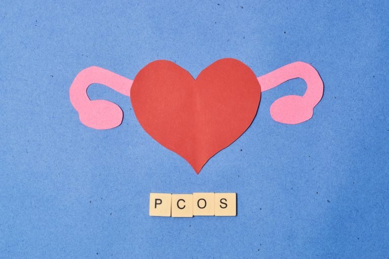 Concept polycystic ovary syndrome, PCOS. Women reproductive system