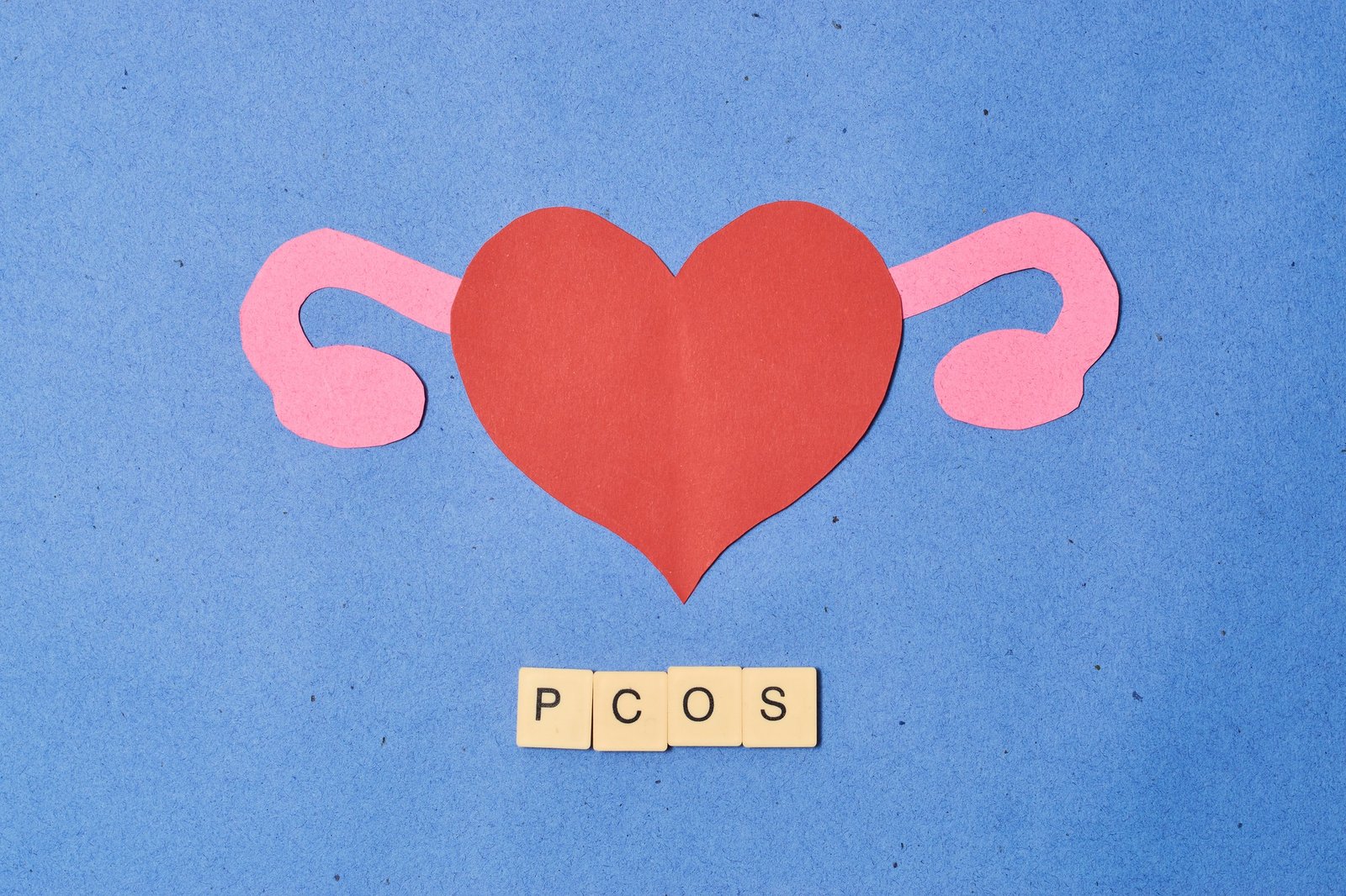 Concept polycystic ovary syndrome, PCOS. Women reproductive system
