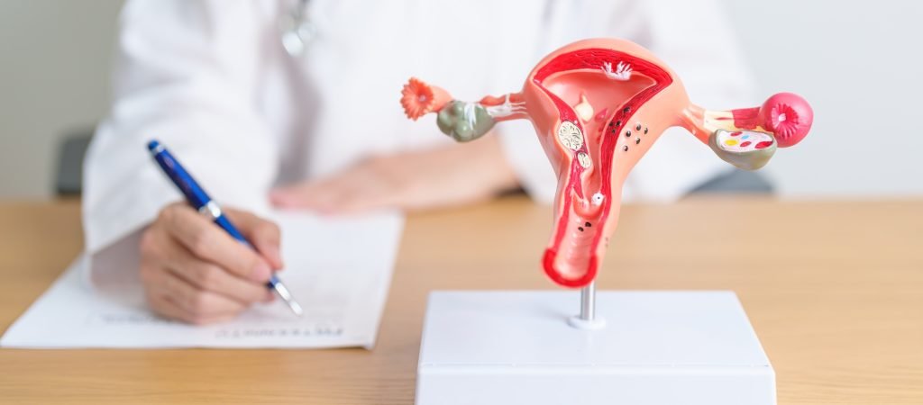 ภาวะถุงน้ำรังไข่หลายใบ (PCOS) คืออะไร