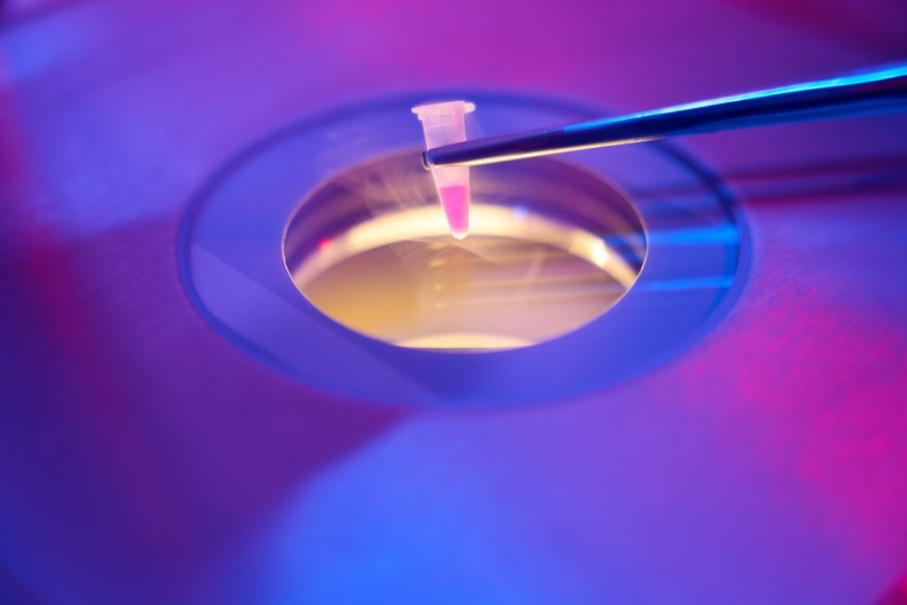แผนการทำ IVF 1 รอบ